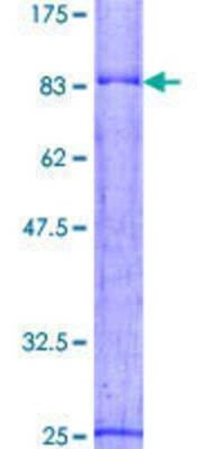 Novus Biologicals Recombinant Human SNX8 GST (N-Term) Protein 2 &mu;g | Buy Online | Novus Biologicals&trade; | Fisher Scientific