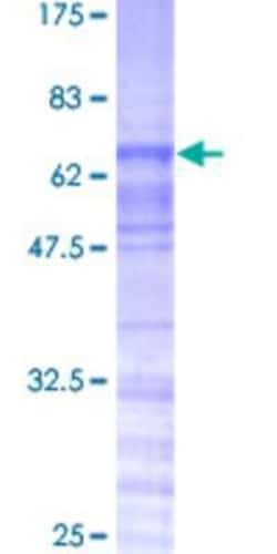 Novus Biologicals Recombinant Human TRA2A GST (N-Term) Protein 25 &mu;g | Buy Online | Novus Biologicals&trade; | Fisher Scientific