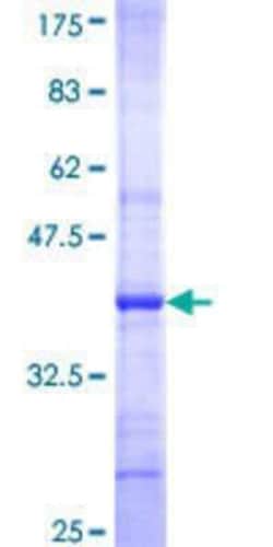 Novus Biologicals Recombinant Human ST8SIA5 GST (N-Term) Protein 10 &mu;g | Buy Online | Novus Biologicals&trade; | Fisher Scientific