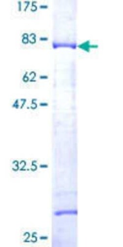 Novus Biologicals Recombinant Human SNX15 GST (N-Term) Protein 25 &mu;g | Buy Online | Novus Biologicals&trade; | Fisher Scientific