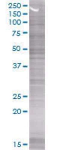 Novus Biologicals SNX15 293T Cell Transient Overexpression Lysate 0.1 mL | Buy Online | Novus Biologicals&trade; | Fisher Scientific