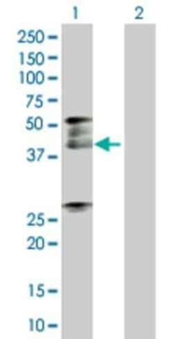 Novus Biologicals&trade;&nbsp;SNX15 293T Cell Transient Overexpression Lysate