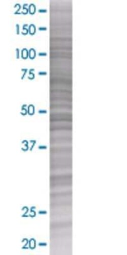 Novus Biologicals SNX15 293T Cell Transient Overexpression Lysate 0.1 mL | Buy Online | Novus Biologicals&trade; | Fisher Scientific