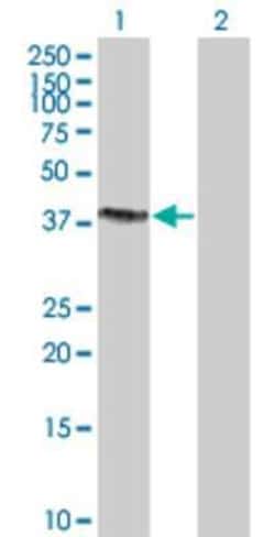Novus Biologicals&trade;&nbsp;SNX15 293T Cell Transient Overexpression Lysate
