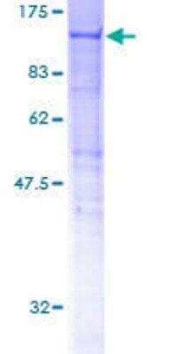 Novus Biologicals Recombinant Human HOOK2 GST (N-Term) Protein 2 &mu;g | Buy Online | Novus Biologicals&trade; | Fisher Scientific