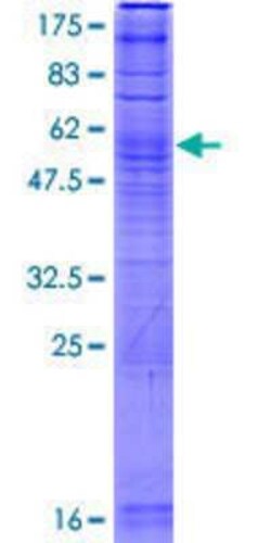 Novus Biologicals Recombinant Human UBIAD1 GST (N-Term) Protein 2 &mu;g | Buy Online | Novus Biologicals&trade; | Fisher Scientific