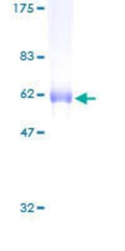 Novus Biologicals Recombinant Human SNX11 GST (N-Term) Protein 2 &mu;g | Buy Online | Novus Biologicals&trade; | Fisher Scientific