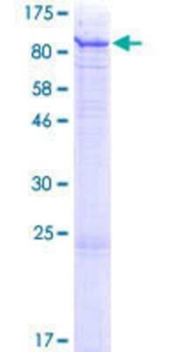 Novus Biologicals Recombinant Human Mic1 GST (N-Term) Protein 2 &mu;g | Buy Online | Novus Biologicals&trade; | Fisher Scientific