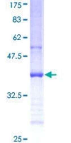 Novus Biologicals Recombinant Human NME7 GST (N-Term) Protein 25 &mu;g | Buy Online | Novus Biologicals&trade; | Fisher Scientific