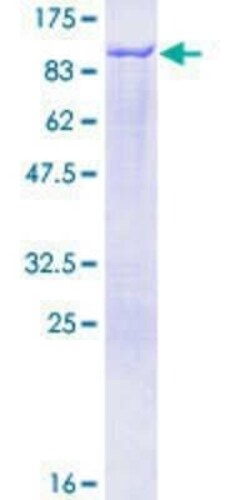 Novus Biologicals Recombinant Human Epsin 1 GST (N-Term) Protein 25 &mu;g | Buy Online | Novus Biologicals&trade; | Fisher Scientific