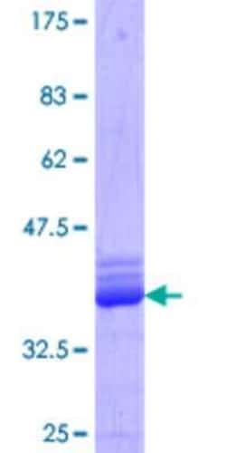 Novus Biologicals Recombinant Human Epsin 1 GST (N-Term) Protein 10 &mu;g | Buy Online | Novus Biologicals&trade; | Fisher Scientific