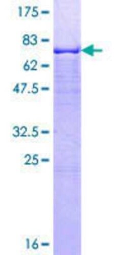 Novus Biologicals Recombinant Human GMPPA GST (N-Term) Protein 10 &mu;g | Buy Online | Novus Biologicals&trade; | Fisher Scientific