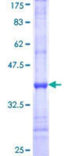 Novus Biologicals Recombinant Human ALG6 GST (N-Term) Protein 10 &mu;g | Buy Online | Novus Biologicals&trade; | Fisher Scientific
