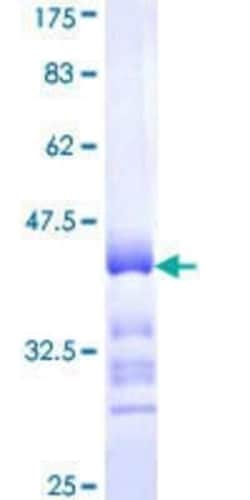 Novus Biologicals Recombinant Human PCDHB1 GST (N-Term) Protein 25 &mu;g | Buy Online | Novus Biologicals&trade; | Fisher Scientific
