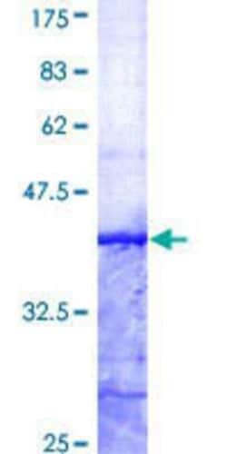 Novus Biologicals Recombinant Human SNX12 GST (N-Term) Protein 10 &mu;g | Buy Online | Novus Biologicals&trade; | Fisher Scientific