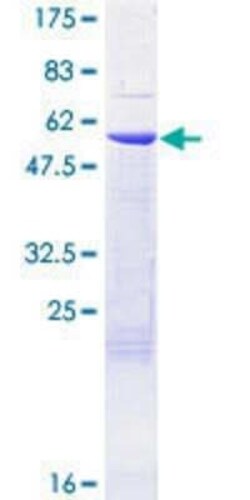 Novus Biologicals Recombinant Human RPA4 GST (N-Term) Protein 25 &mu;g | Buy Online | Novus Biologicals&trade; | Fisher Scientific