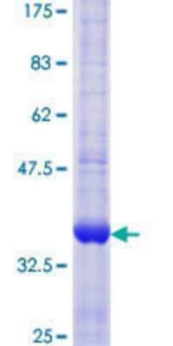 Novus Biologicals Recombinant Human RPA4 GST (N-Term) Protein 10 &mu;g | Buy Online | Novus Biologicals&trade; | Fisher Scientific