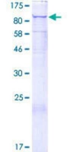 Novus Biologicals Recombinant Human SART2 GST (N-Term) Protein 2 &mu;g | Buy Online | Novus Biologicals&trade; | Fisher Scientific