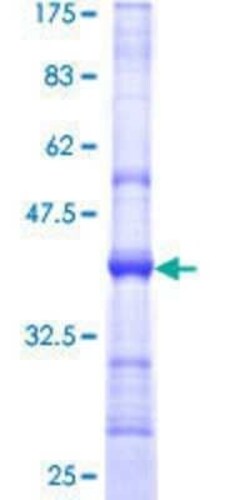 Novus Biologicals Recombinant Human SART2 GST (N-Term) Protein 10 &mu;g | Buy Online | Novus Biologicals&trade; | Fisher Scientific