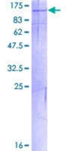 Novus Biologicals Recombinant Human PKN3 GST (N-Term) Protein 2 &mu;g | Buy Online | Novus Biologicals&trade; | Fisher Scientific