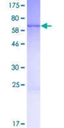 Novus Biologicals Recombinant Human PURG GST (N-Term) Protein 25 &mu;g | Buy Online | Novus Biologicals&trade; | Fisher Scientific