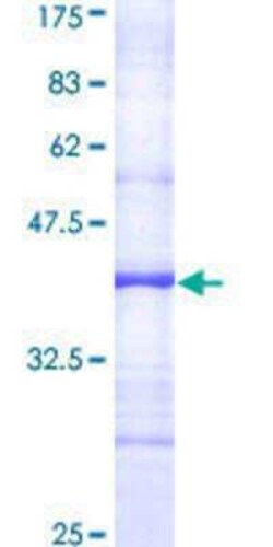 Novus Biologicals Recombinant Human Apc4 GST (N-Term) Protein 25 &mu;g | Buy Online | Novus Biologicals&trade; | Fisher Scientific