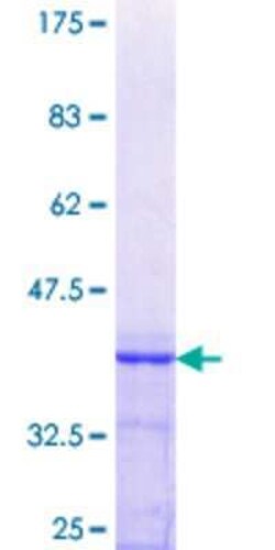 Novus Biologicals Recombinant Human OSGIN1 GST (N-Term) Protein 10 &mu;g | Buy Online | Novus Biologicals&trade; | Fisher Scientific