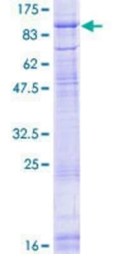 Novus Biologicals Recombinant Human POMT2 GST (N-Term) Protein 10 &mu;g | Buy Online | Novus Biologicals&trade; | Fisher Scientific