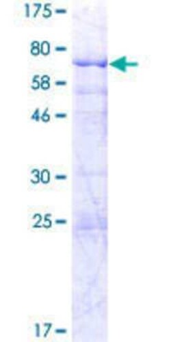 Novus Biologicals Recombinant Human SLC25A24 GST (N-Term) Protein 2 &mu;g | Buy Online | Novus Biologicals&trade; | Fisher Scientific