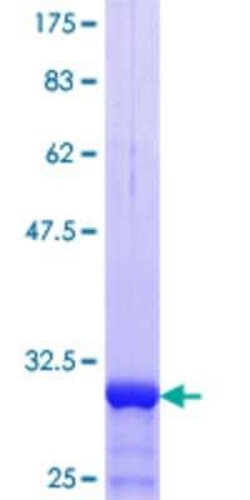 Novus Biologicals Recombinant Human SLC25A24 GST (N-Term) Protein 10 &mu;g | Buy Online | Novus Biologicals&trade; | Fisher Scientific