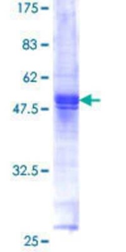 Novus Biologicals Recombinant Human CDIP GST (N-Term) Protein 10 &mu;g | Buy Online | Novus Biologicals&trade; | Fisher Scientific