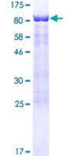 Novus Biologicals Recombinant Human SCHIP1 GST (N-Term) Protein 10 &mu;g | Buy Online | Novus Biologicals&trade; | Fisher Scientific