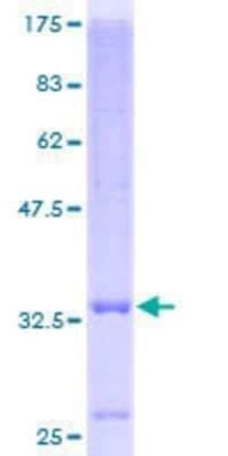 Novus Biologicals Recombinant Human SLC39A3 GST (N-Term) Protein 10 &mu;g | Buy Online | Novus Biologicals&trade; | Fisher Scientific