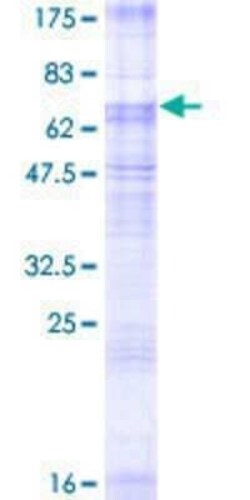 Novus Biologicals Recombinant Human Glucose Transporter GLUT8 GST (N-Term) Protein 2 &mu;g | Buy Online | Novus Biologicals&trade; | Fisher Scientific