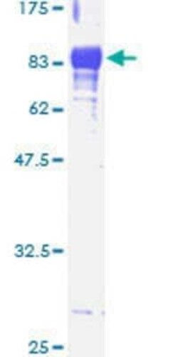 Novus Biologicals Recombinant Human PACSIN1 GST (N-Term) Protein 25 &mu;g | Buy Online | Novus Biologicals&trade; | Fisher Scientific