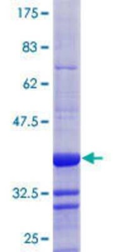 Novus Biologicals Recombinant Human BAZ2B GST (N-Term) Protein 25 &mu;g | Buy Online | Novus Biologicals&trade; | Fisher Scientific