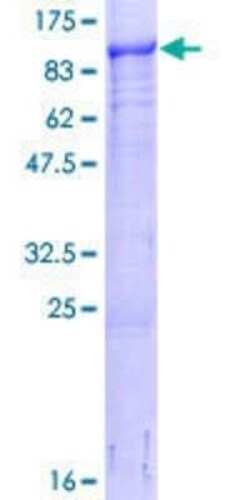 Novus Biologicals Recombinant Human LMCD1 GST (N-Term) Protein 25 &mu;g | Buy Online | Novus Biologicals&trade; | Fisher Scientific