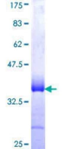 Novus Biologicals Recombinant Human LMCD1 GST (N-Term) Protein 10 &mu;g | Buy Online | Novus Biologicals&trade; | Fisher Scientific