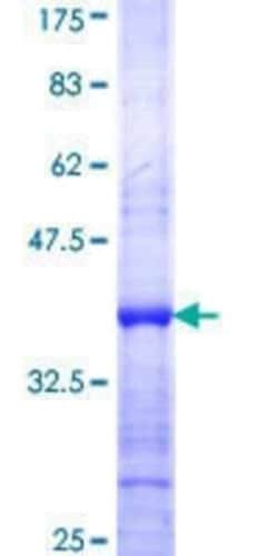 Novus Biologicals Recombinant Human GLTSCR2 GST (N-Term) Protein 25 &mu;g | Buy Online | Novus Biologicals&trade; | Fisher Scientific