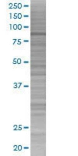 Novus Biologicals CIN85/SH3KBP1 293T Cell Transient Overexpression Lysate 0.1 mL | Buy Online | Novus Biologicals&trade; | Fisher Scientific