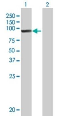 Novus Biologicals CIN85/SH3KBP1 293T Cell Transient Overexpression Lysate 0.1 mL | Buy Online | Novus Biologicals&trade; | Fisher Scientific
