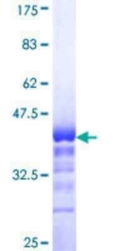 Novus Biologicals Recombinant Human TLX3 GST (N-Term) Protein 10 &mu;g | Buy Online | Novus Biologicals&trade; | Fisher Scientific