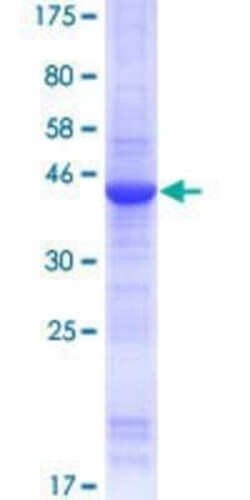 Novus Biologicals Recombinant Human SPANXA1 GST (N-Term) Protein 10 &mu;g | Buy Online | Novus Biologicals&trade; | Fisher Scientific