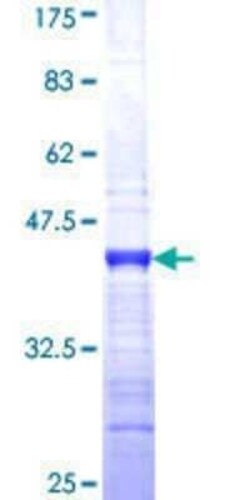 Novus Biologicals Recombinant Human SOX8 GST (N-Term) Protein 25 &mu;g | Buy Online | Novus Biologicals&trade; | Fisher Scientific