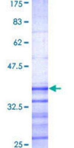 Novus Biologicals Recombinant Human KChIP2 GST (N-Term) Protein 25 &mu;g | Buy Online | Novus Biologicals&trade; | Fisher Scientific