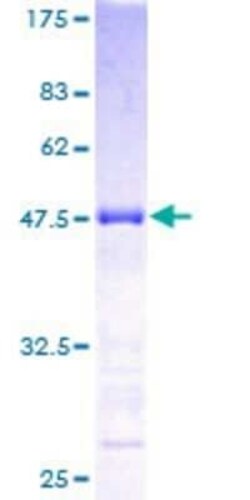 Novus Biologicals Recombinant Human VABP GST (N-Term) Protein 10 &mu;g | Buy Online | Novus Biologicals&trade; | Fisher Scientific