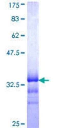Novus Biologicals Recombinant Human EHD2 GST (N-Term) Protein 25 &mu;g | Buy Online | Novus Biologicals&trade; | Fisher Scientific