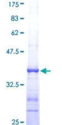 Novus Biologicals Recombinant Human PIK3R4 GST (N-Term) Protein 25 &mu;g | Buy Online | Novus Biologicals&trade; | Fisher Scientific
