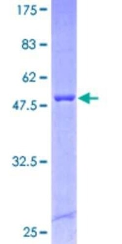 Novus Biologicals Recombinant Human SCAPER GST (N-Term) Protein 25 &mu;g | Buy Online | Novus Biologicals&trade; | Fisher Scientific