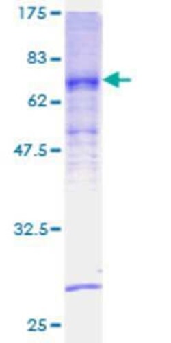 Novus Biologicals Recombinant Human WDR8 GST (N-Term) Protein 2 &mu;g | Buy Online | Novus Biologicals&trade; | Fisher Scientific